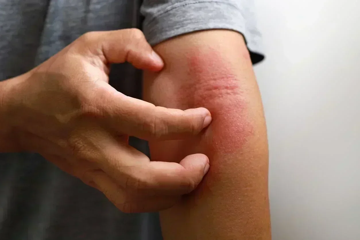 Board-certified allergist providing expert care